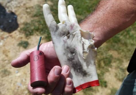 Maryland State Fire Marshal bomb squad member shows the aftermath of a rubber hand that held a quarter stick illegal firework, left, to show the danger of using illegal fireworks